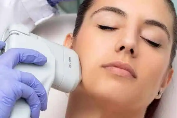 Image of woman having HIFU Knutsford treatment
