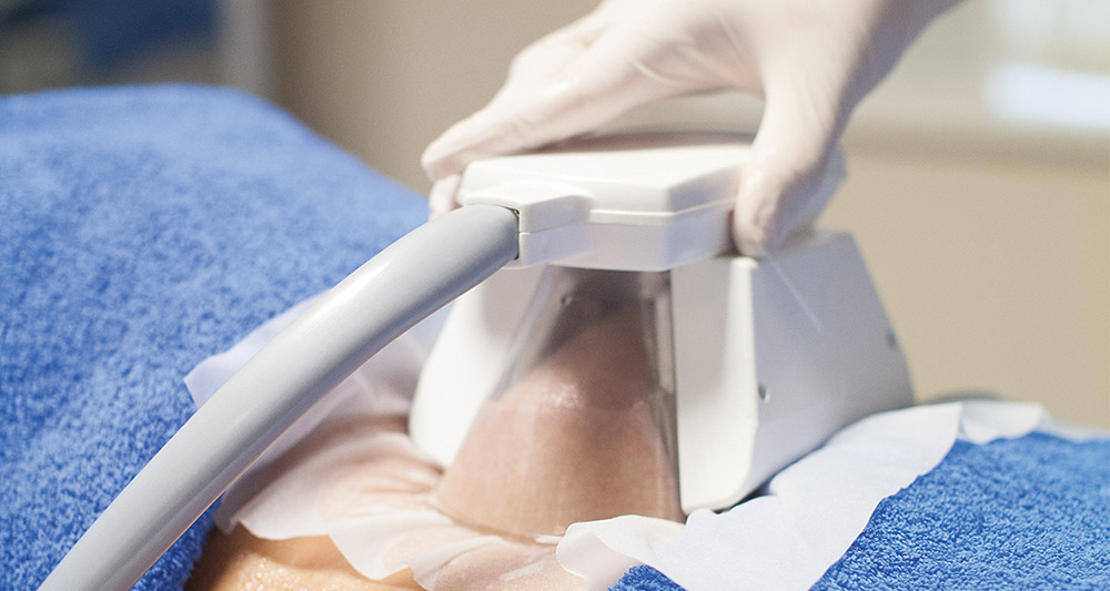 How Fat Freezing and HIFU Work Together? 2 Multiple Areas in One Session HIFU and Fat Freezing Knutsford