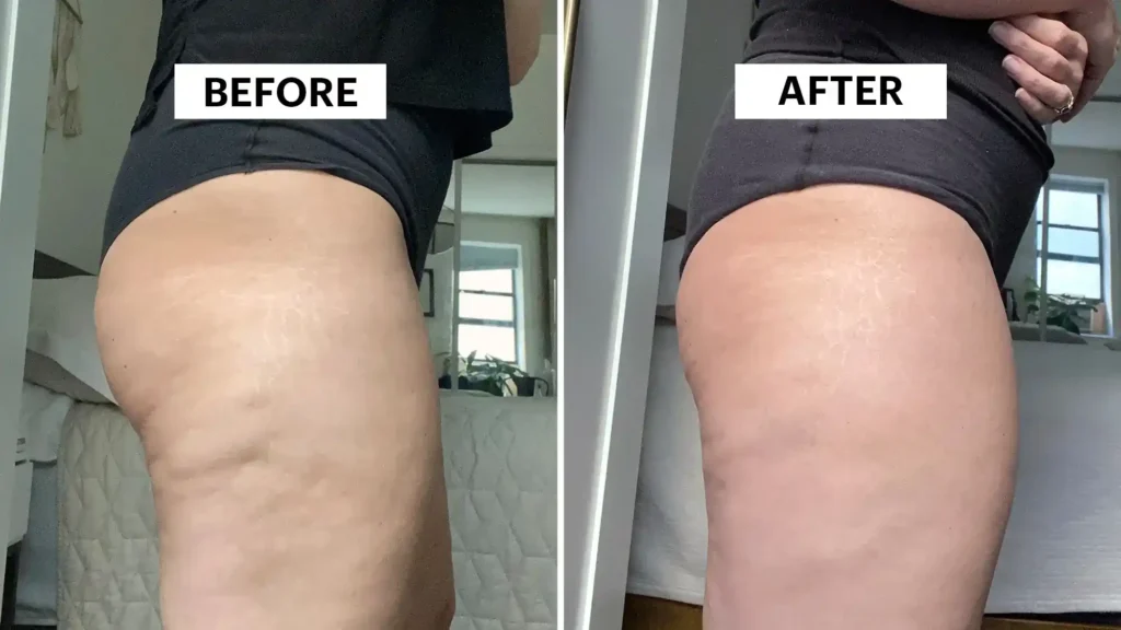 Do Toning Exercise Knutsford Really Tackle Cellulite?