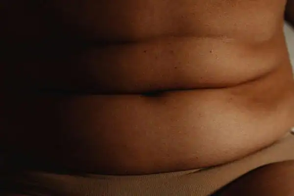 The Hidden Connection: How Stress Shapes Your Fitness and Body Composition 3 image of what stress can do on the stomach area and how Lipo 360 Knutsford can help to change your body shape.